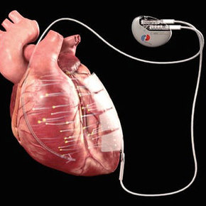 Новый имплант запускает регенерацию сердечной ткани электрическими импульсами