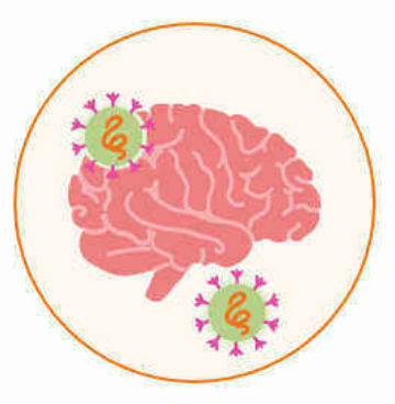 Исследование: Коронавирус поражает нервную систему и мозг